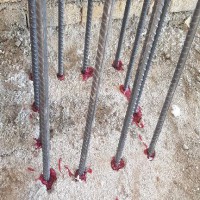 تکنسین کاشت بولت