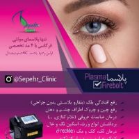 پلاسما : Plasma FIREBOLT