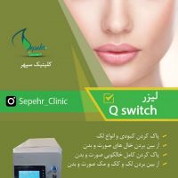 کیوسوئیچ Qswitch