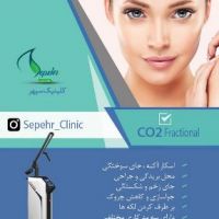 Co2 فرکشنال