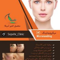 میکرونیدلینگ Microneedling