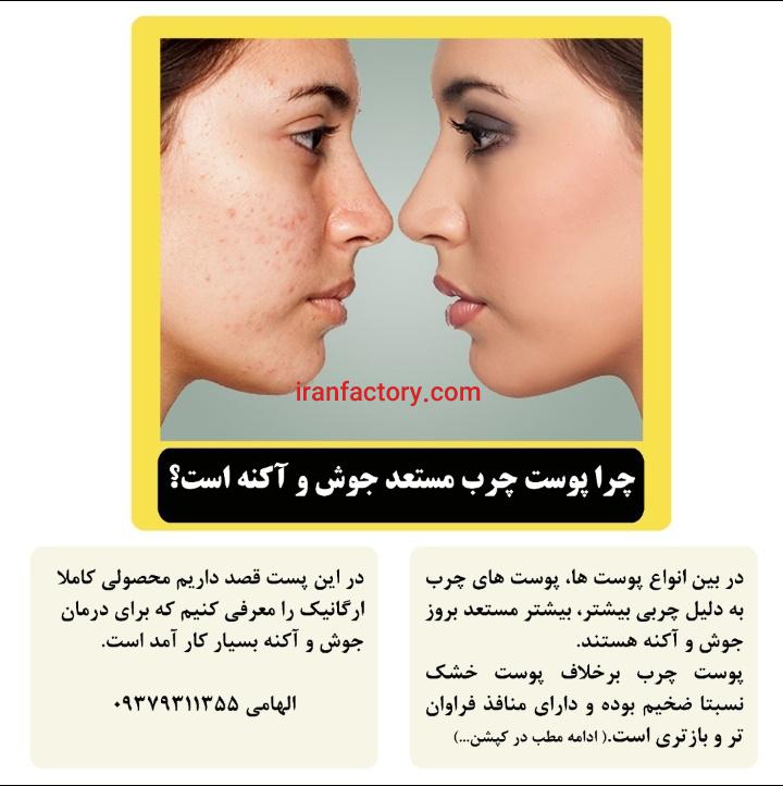 درمان خانگی جوش و آکنه با اسکراب مدیترانه ای0