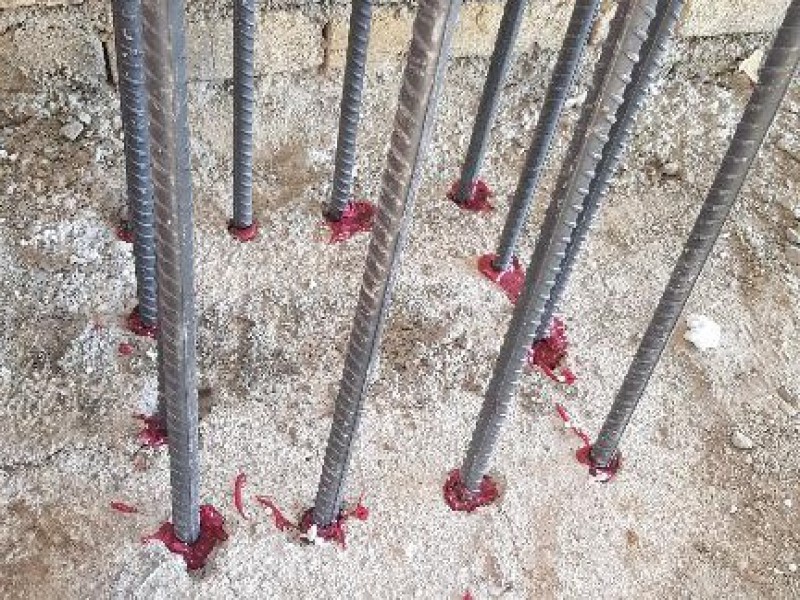 تکنسین کاشت بولت0