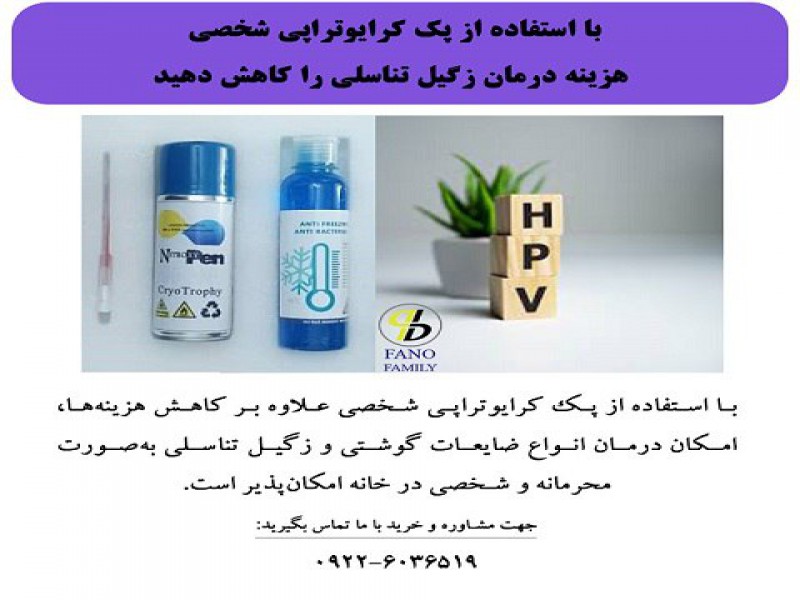 کاهش هزینه درمان زگیل تناسلی در منزل0
