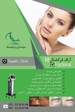 آر اف سوزنی : RF Fractional Secret0