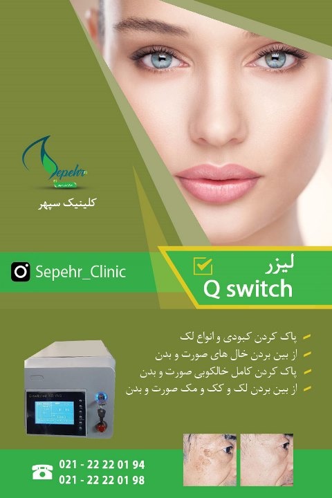 کیوسوئیچ Qswitch0
