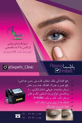 پلاسما : Plasma FIREBOLT