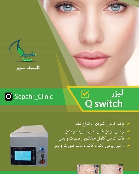 کیوسوئیچ Qswitch