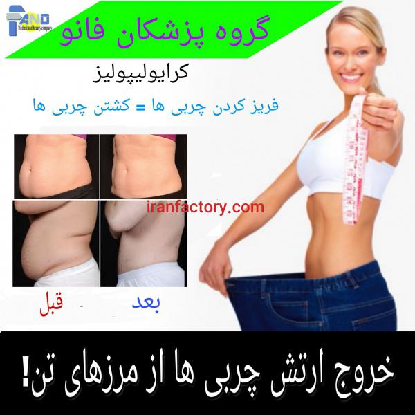 خدمات لاغری کرایولیپولیز